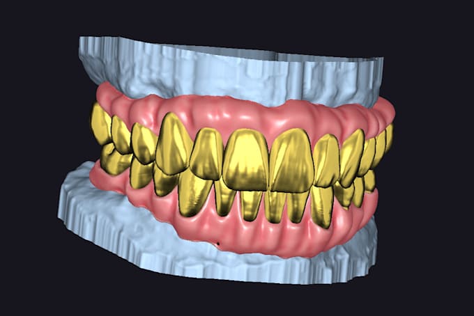provide you excellent dental prothetic designs using exocad