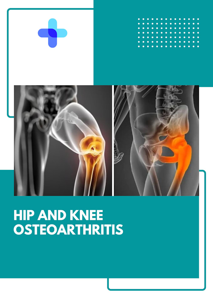 write high quality articles about knee and hip osteoarthritis
