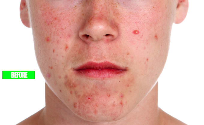 cprofessionally smooth spotty photos