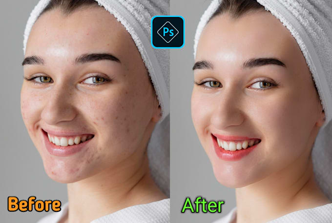 do skin retouching and photo editing to remove pimples and dark spots