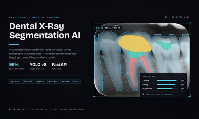 bring your computer vision and machine learning projects to life