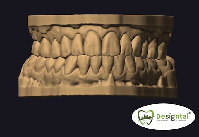 do master crafted dental design for smiledesign and waxups