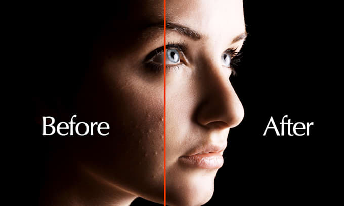 remove acne and blemishes from photos