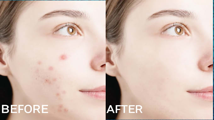 Add parts to the image and remove the parts that are not need by Money ...