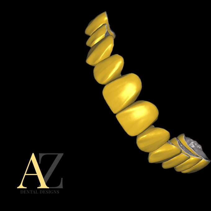 design crown and bridge using exocad