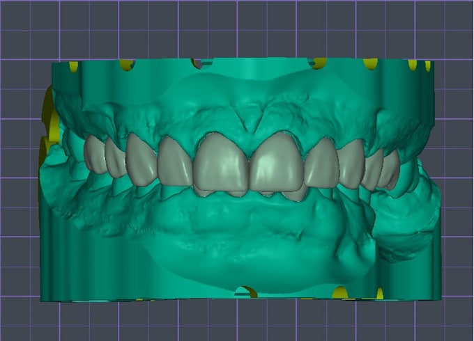 design full anatomic crowns