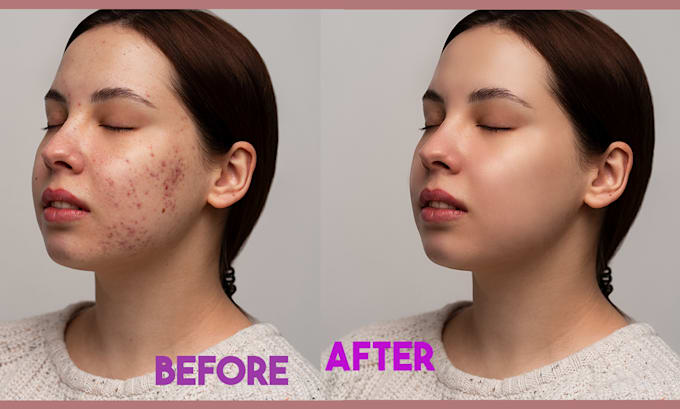 do professional high end skin retouching