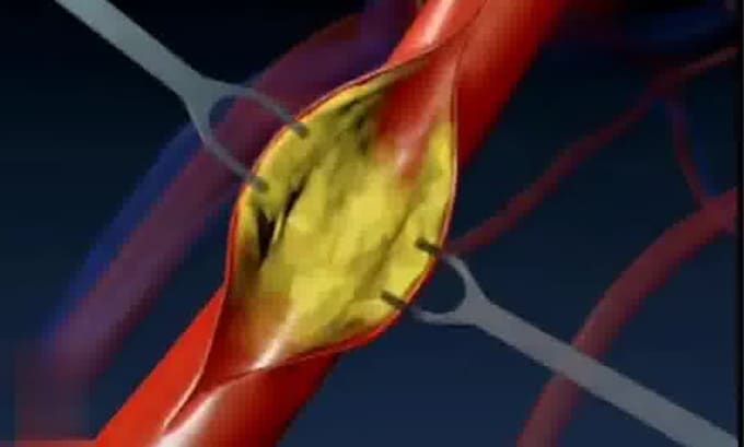 3d vfx medical animation dental animation 3d explainer video surgery animation