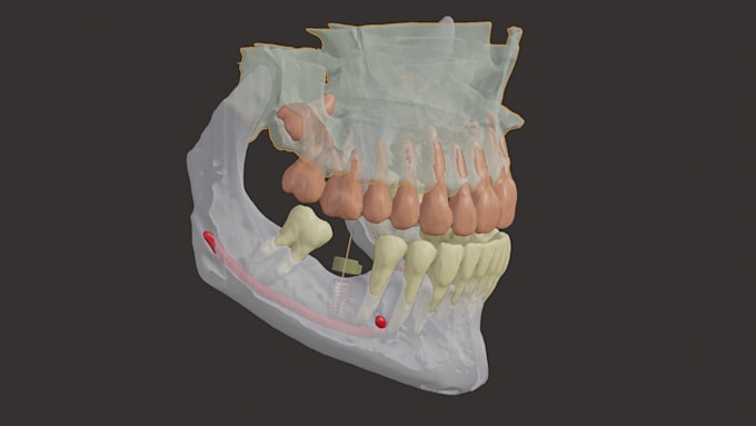 create a 3d biomodel printable  for surgical plans