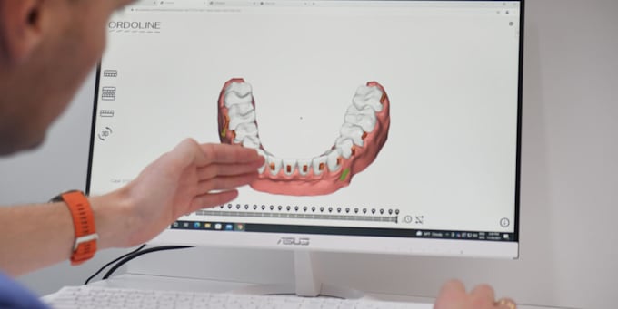 provide expert aligner treatment planning services