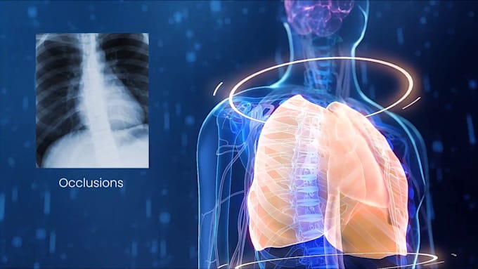 create 3d medical animation, medical explainer, surgery