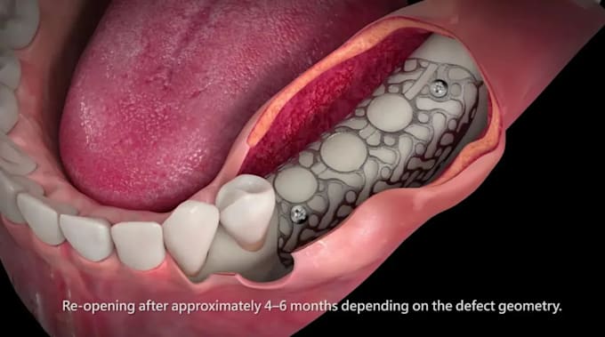 do 3d dental animation, 3d medical animation, surgery animation and 3d animation