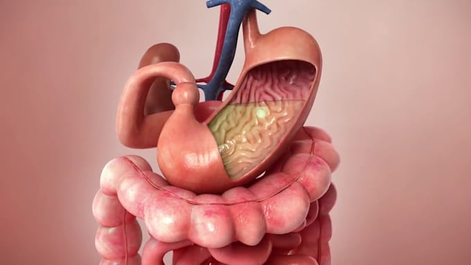 do 3d medical animation video surgery animation surgical model 3d dental video