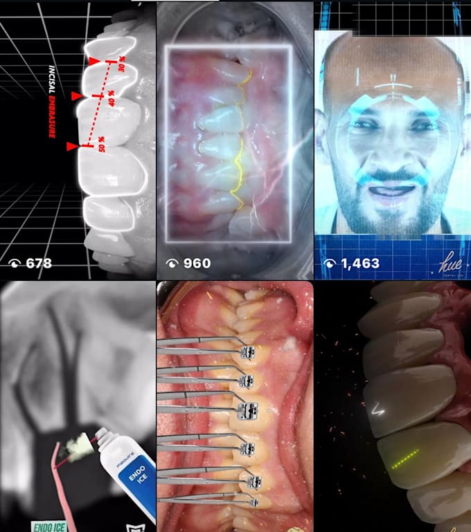 high quality dental motion graphics to elevate your marketing