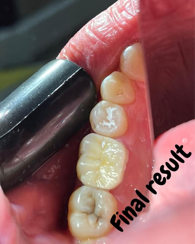 design professional dental cad designs using exocad