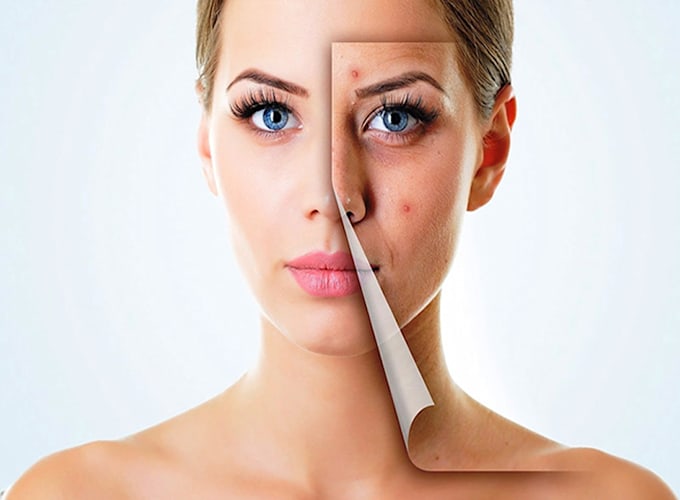 skincare second opinion by MD