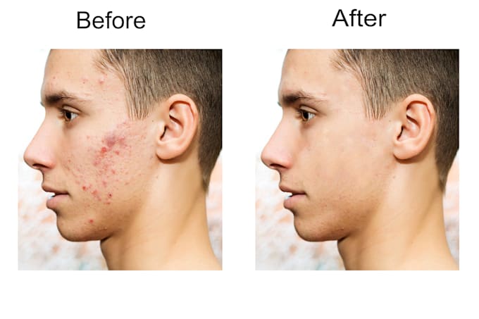 Remove stains and will do professional skin retouching by Muhammad ...