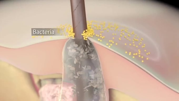Create 3d dermatology skincare and hair follicle animation by Leksontee ...