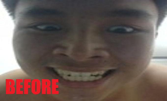 share my huge forehead for your joy, mental recovery needs