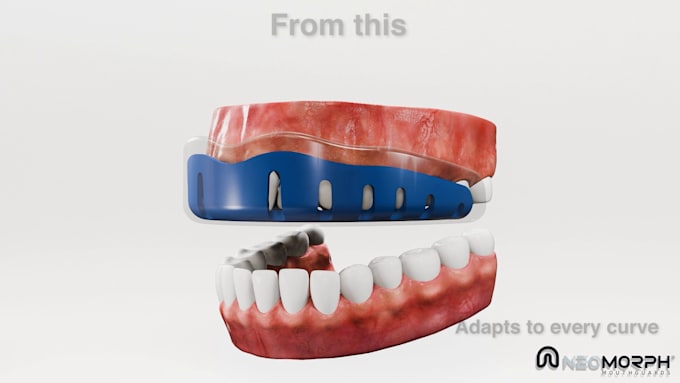 3d dental animation orthodontic animation 3d gum disease video medical animation