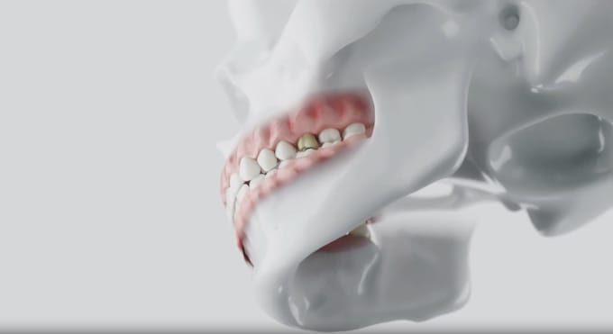 do 3d medical animation 3d surgery animation 3d explainer video
