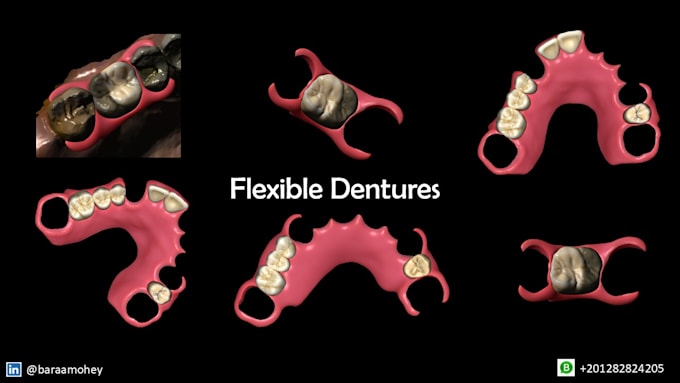 design any dental restorations you need using exocad