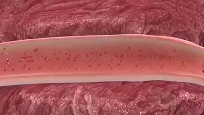 3d medical explainer video, 3d medical animation video, 3d product animation