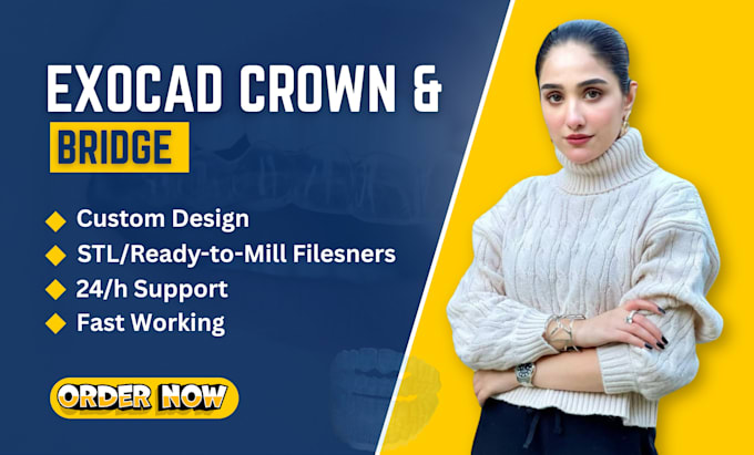 Design crowns and bridges using exocad by Mehak_ali13 | Fiverr