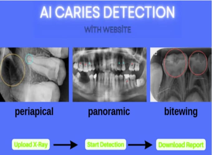 develop ai teeth caries detector with dental clinic website