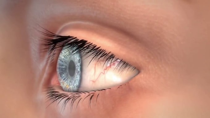 create 3d medical animation, medical explainer, surgery animation, anatomy video