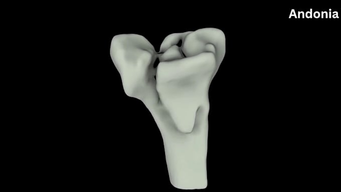 do 3d medical animation, 3d surgical animation, 3d radius implantation animation