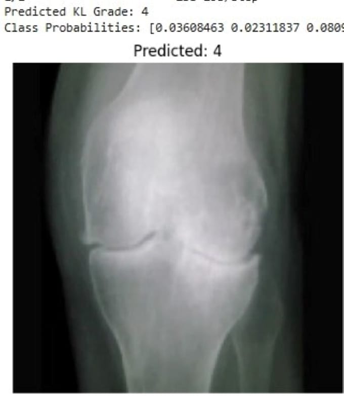 do medical imaging ai for disease classification by grad cam mri xray radiology