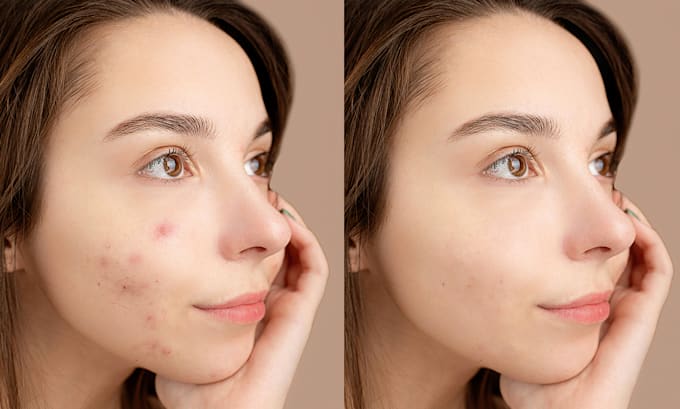 remove blemishes and smooth skin in a portrait
