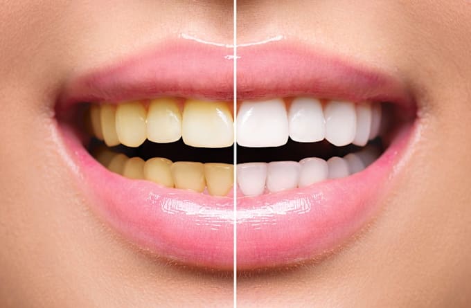 make your teeth whiter and your smile look natural