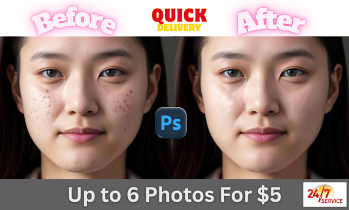 remove pimples and dark spots from the face and body