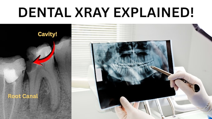 professionally read and explain your dental x rays