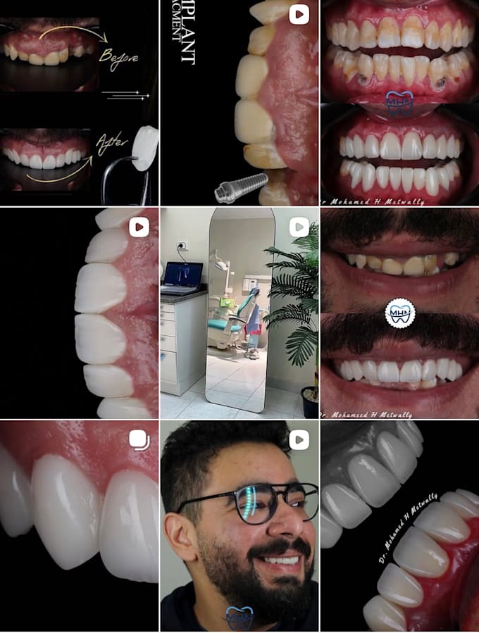 transform your dental work into creative videos