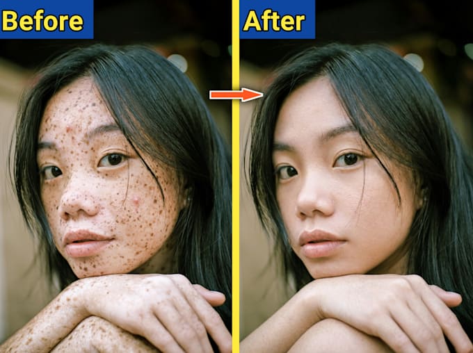professional skin retouching, face retouch, blemish removal