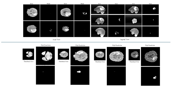 build medical imaging and computer vision models using deep learning