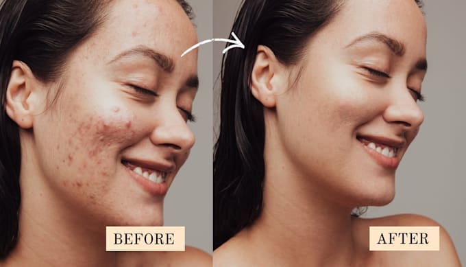professionally retouch and edit skin