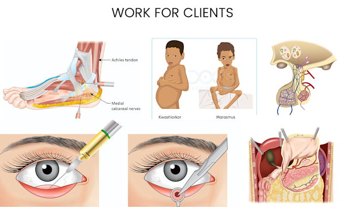 create detailed medical and anatomical illustrations