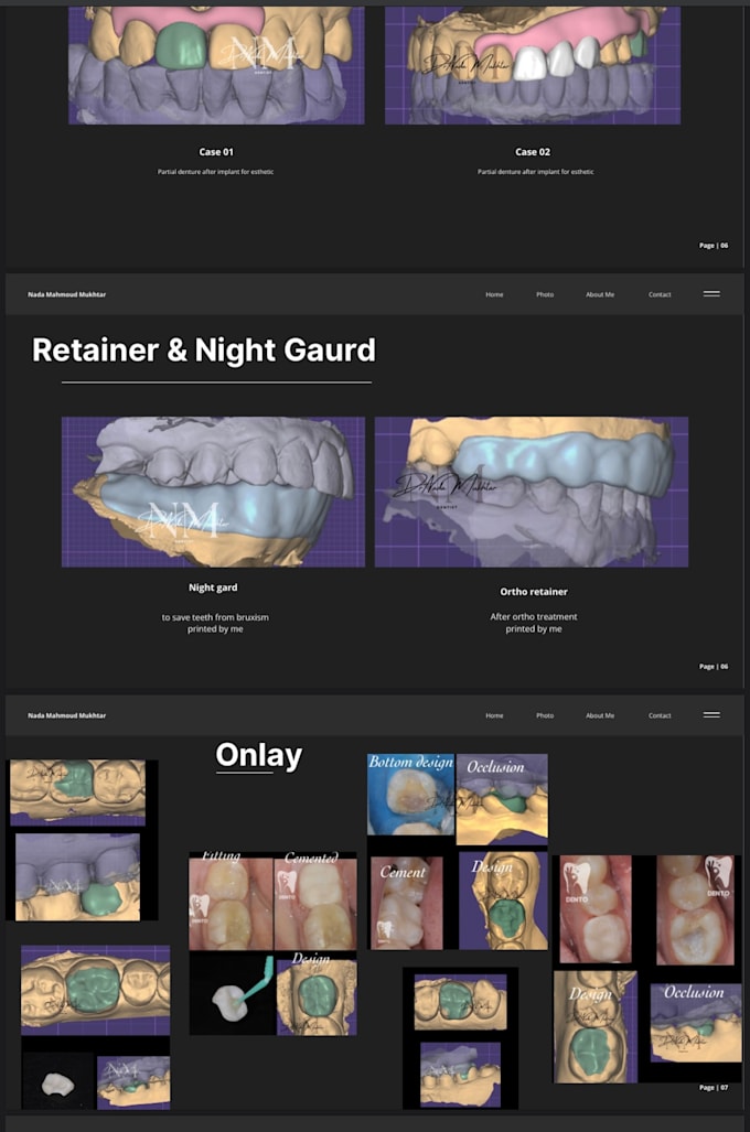 do highly percise dental prothesis and surgical guide
