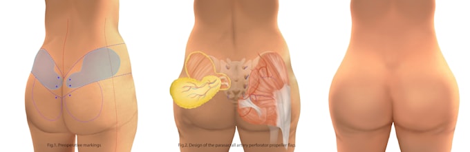 create medical illustration with anatomically precise