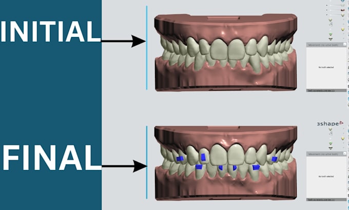 do dental clear aligner treatment planning on onyxceph and 3shape