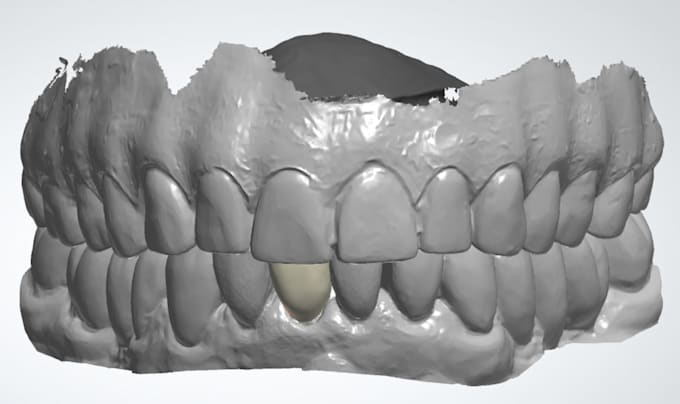 design crown, bridge, rpd, dentures and wax up using 3shape software