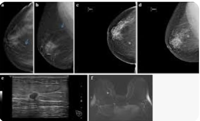 help you better understand your imaging results