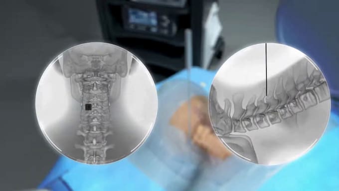 create professional 3d medical animation for orthopedic surgery and anatomy