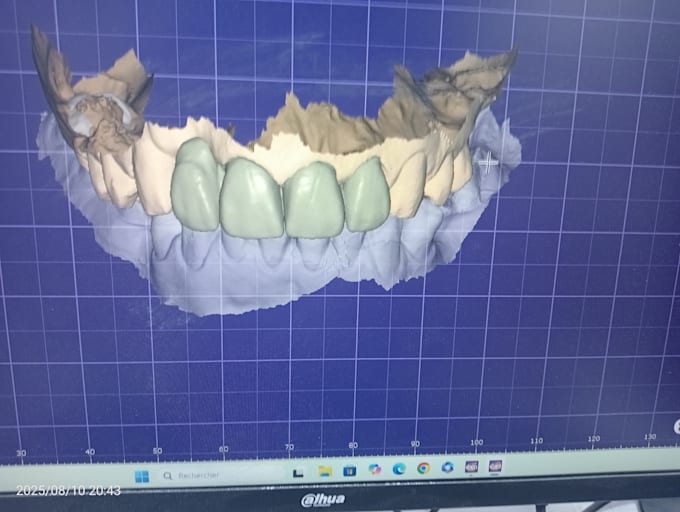design high precision 3d dental models