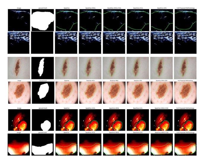 build a medical image segmentation model using deep learning