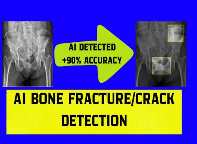 build ai bone fracture detection system with web interface